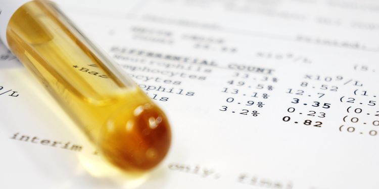 Photo of a tube with human serum on desk with lab results