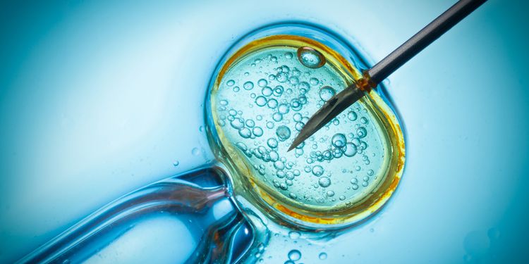 Photo of in vitro fertiliztion procedure