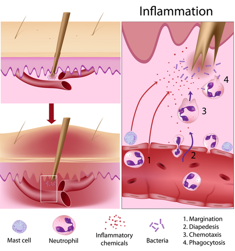 Inflammation Response