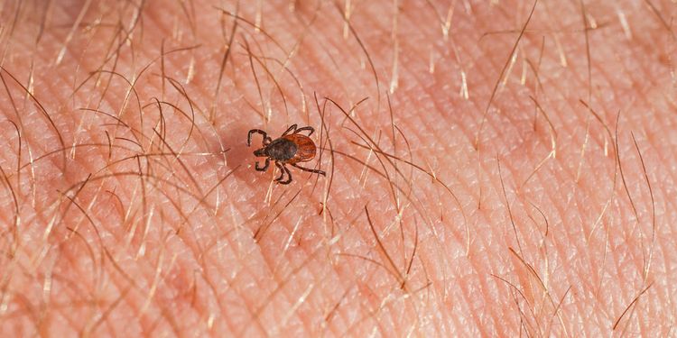 Photo of a TIck on human skin