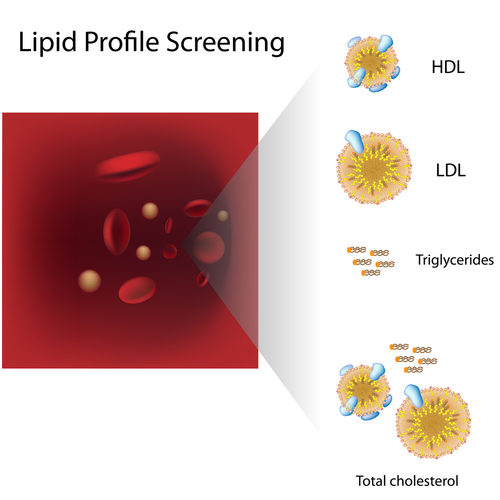 Illustration of a Lipid Profile Blood Test