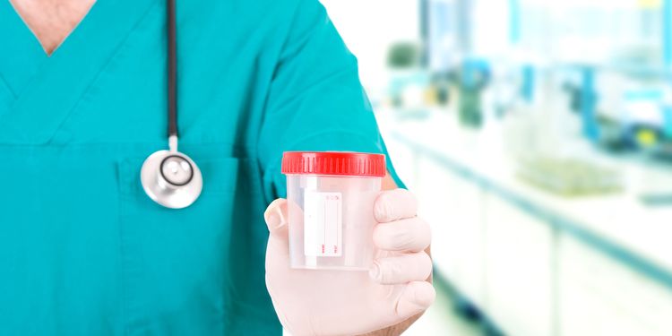 Photo of a lab technician holding a urine jar