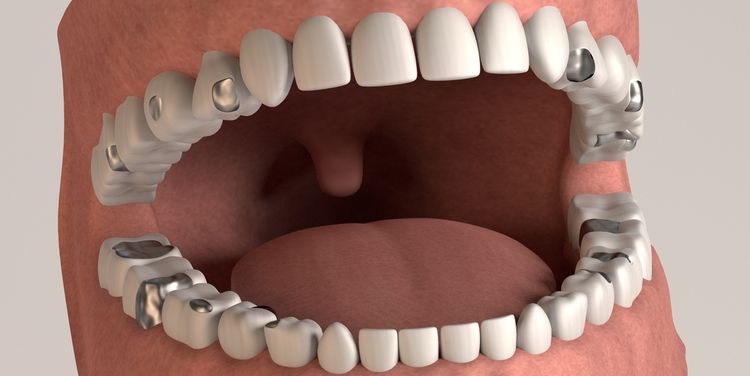 Photo of a 3D model of human teeth