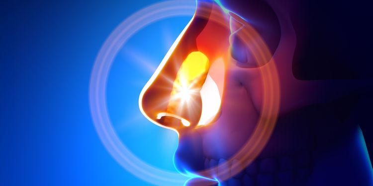 Illustration of nasal septum deviation