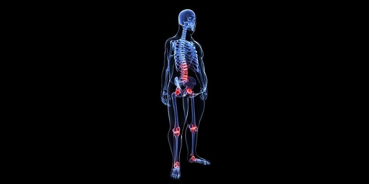 Illustration of joint inflammation in overweight person