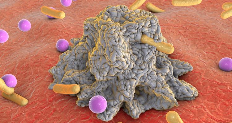 illustration of undigested gluten that serves as a fod for bacteria