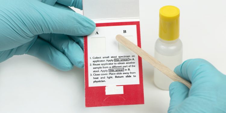 Photo of a stool testing kit for digestive problems