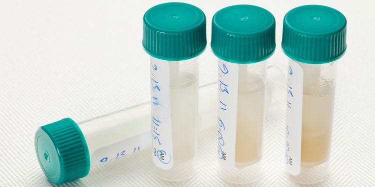 Photo of testing tube for saliva adrenal testing