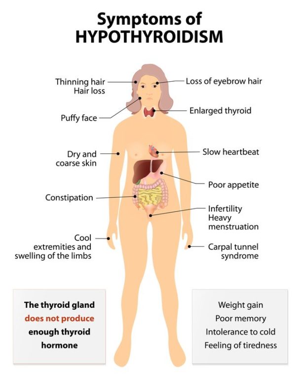 Depression Cause Hypothyroidism