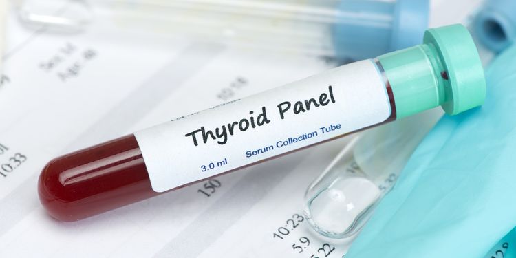 Photo of blood tube saying Thyroid panel on a label