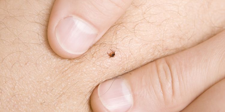 Photo of a tick on a skin