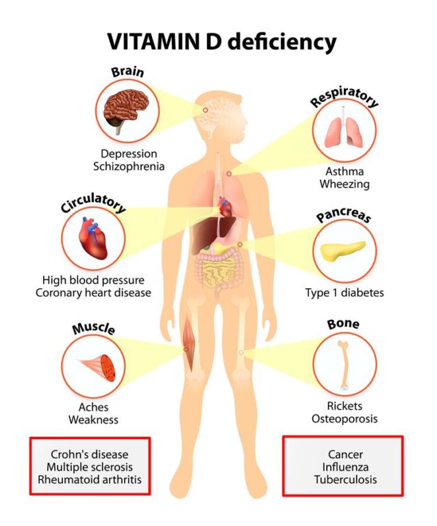 Illustration of human body with vitamin D deficiency